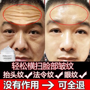 祛除皱纹神器抬头纹去除男士提拉紧致六胜肽抗皱面霜抗衰老护肤品