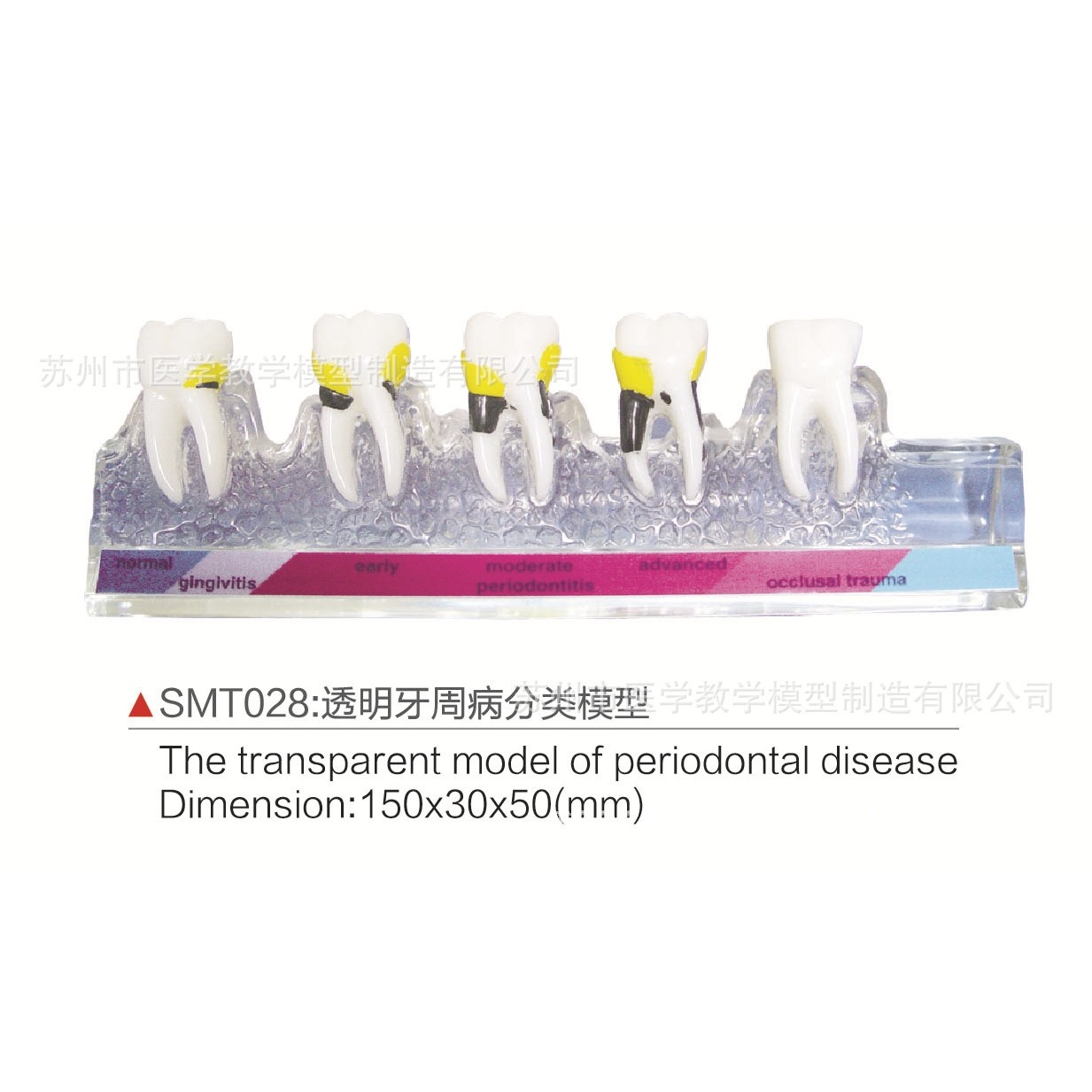 SMT028透明牙Z病分类模型,文具电教/文化用品/商务用品,教学标本/模型,淘宝优惠券,粉丝福利购,淘宝优惠卷