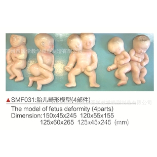 SMF031胎儿畸形模型(4部件)