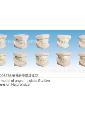 SMD03575安氏分类错颌模型
