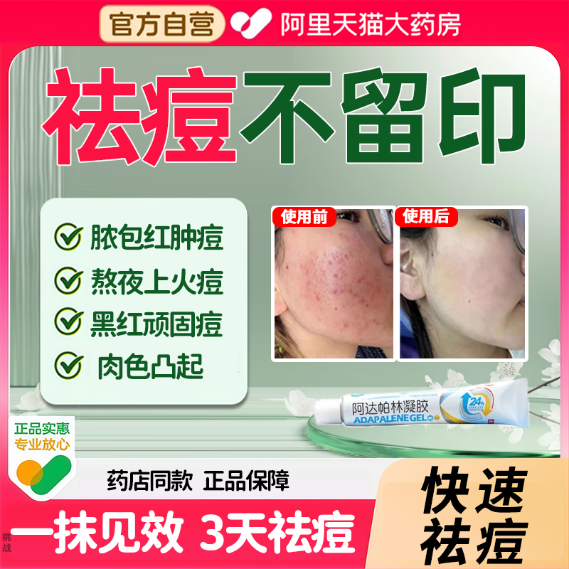 【丽芙】阿达帕林凝胶0.1%*35g*1支/盒