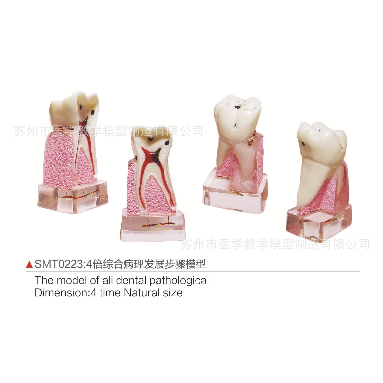SMT0223  4倍综合病理发展步骤模型,文具电教/文化用品/商务用品,教学标本/模型,淘宝优惠券,粉丝福利购,淘宝优惠卷