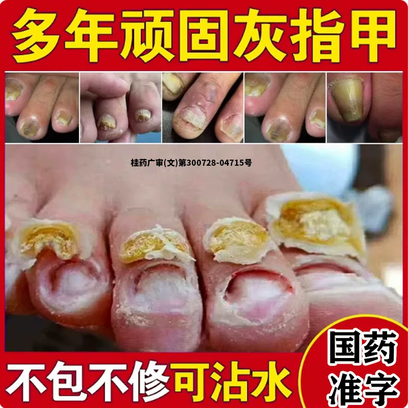 [乐偌]硝酸咪康唑乳膏2%*10g*1支/盒图片