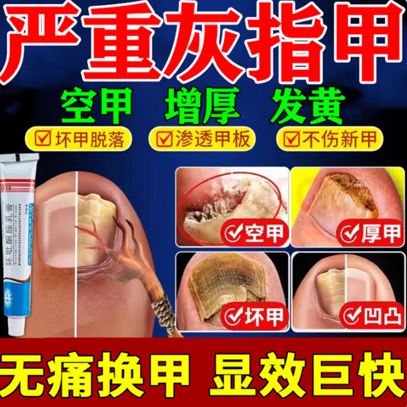 【亮生】环吡酮胺乳膏1%*15g*1支/盒