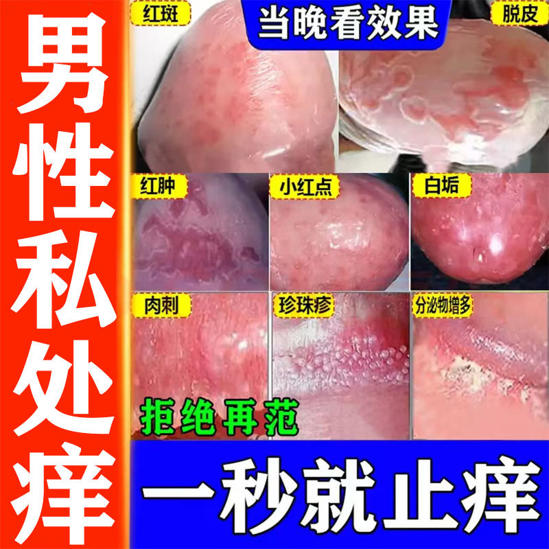 【白云山】曲咪新乳膏10g*1支/盒
