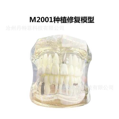 M2001病理模型牙齿模型备牙嵌体龋齿模型种植模型牙齿可拆卸