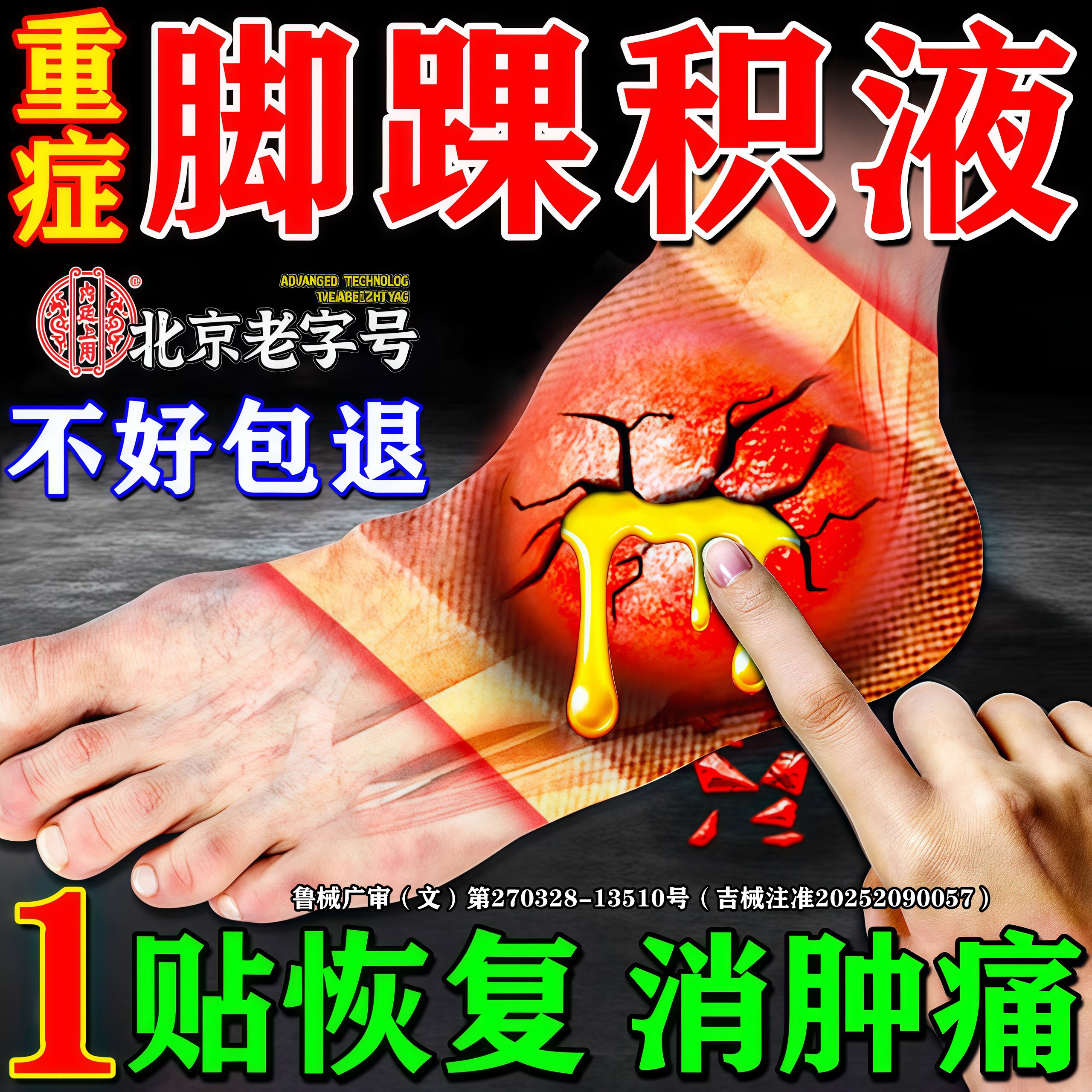 无效包全退！脚踝积液800%包冶好图片