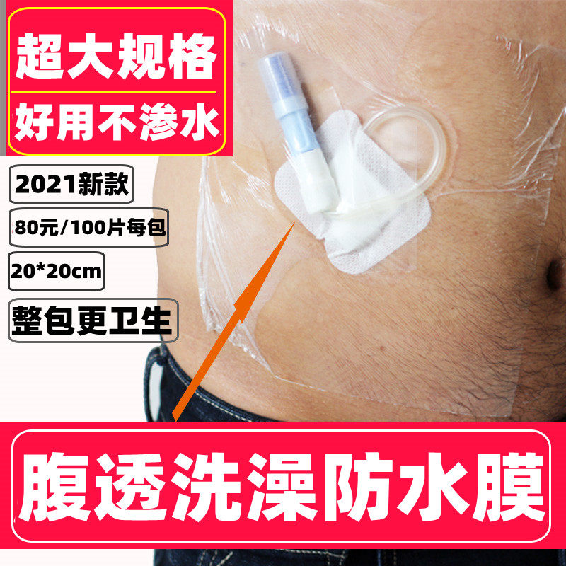 腹透洗澡袋膜透洗澡保护膜腹透洗澡膜腹透用品洗澡贴膜肛门袋膜透