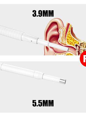 掏耳神AN103皮器视耳勺3.9mm镜可视化挖头勺耳镜耳耳朵内窥镜高可