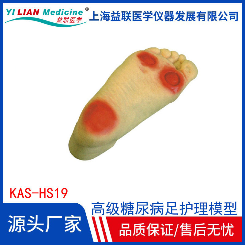 糖*尿*病足护理模型足部病理变化烂脚脚趾感染教具老年足部护理