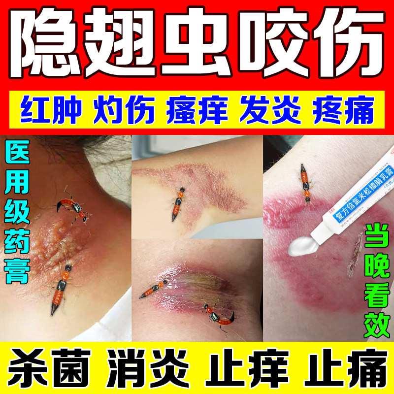 【延字牌】复方倍氯米松樟脑乳膏10g*1支/盒