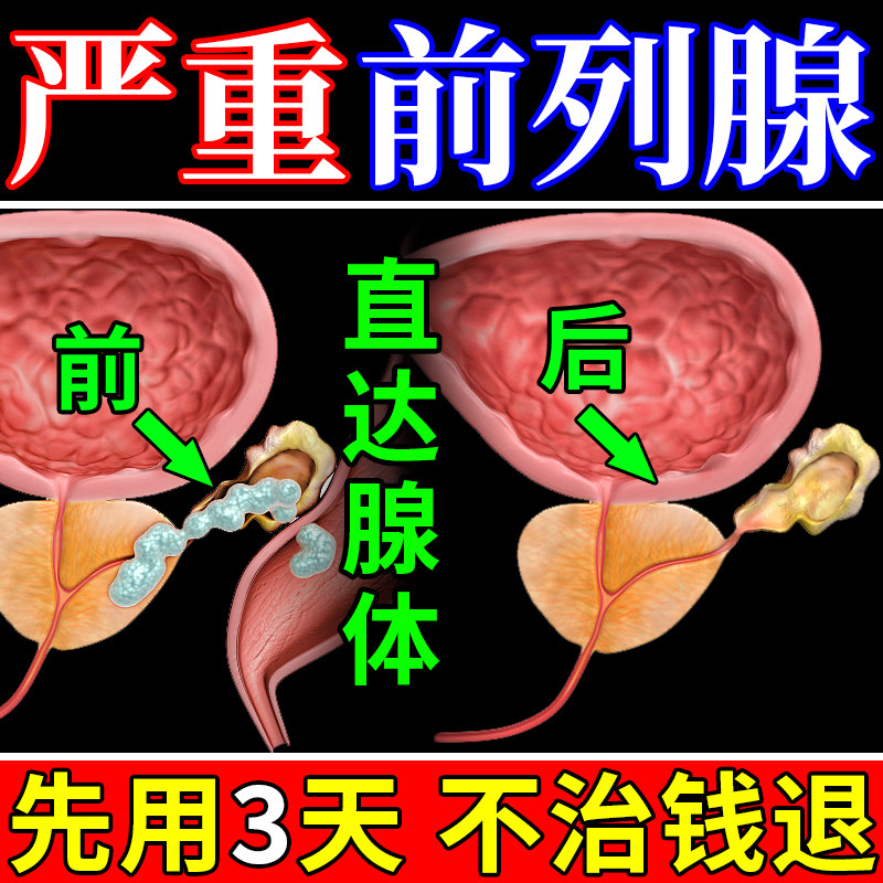 前列腺药贴炎官用专方旗舰店