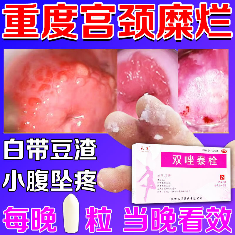 甲硝唑栓治疗宫颈糜烂的药阴道炎妇科用药二度三度消糜重度专用