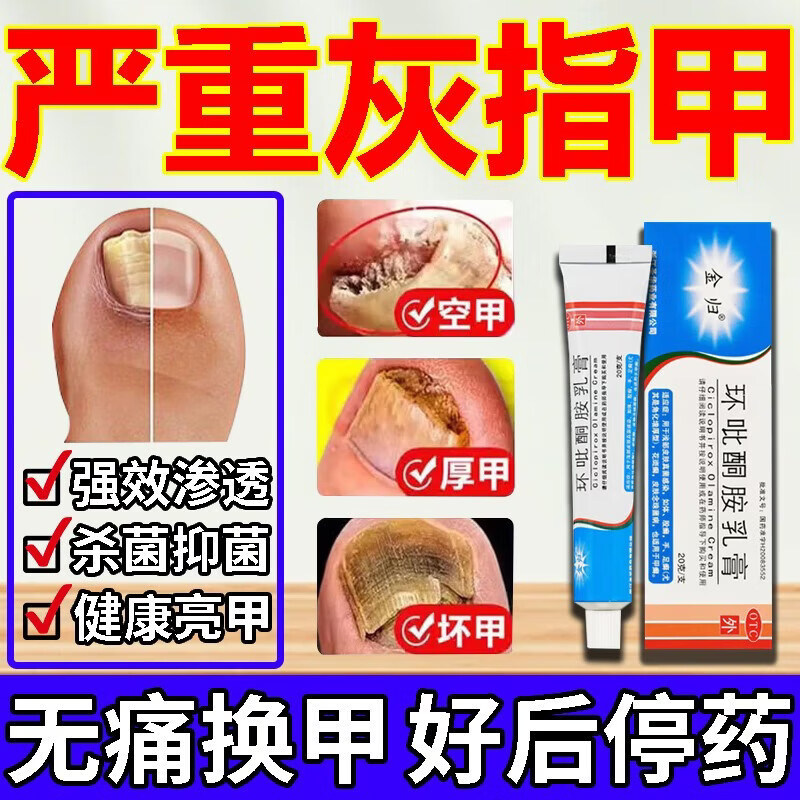 复方环吡聚维酮胺碘乳膏剂灰指甲特专用效药第根一名治真菌感染药