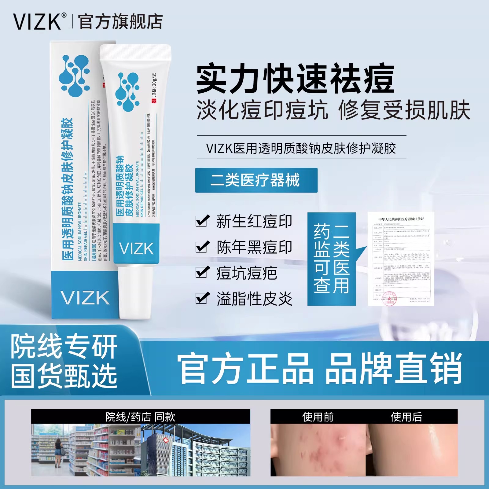 vizk透明质酸钠淡痘印褪红祛痘痘印闭口修护凝胶性皮炎玫瑰型痤疮