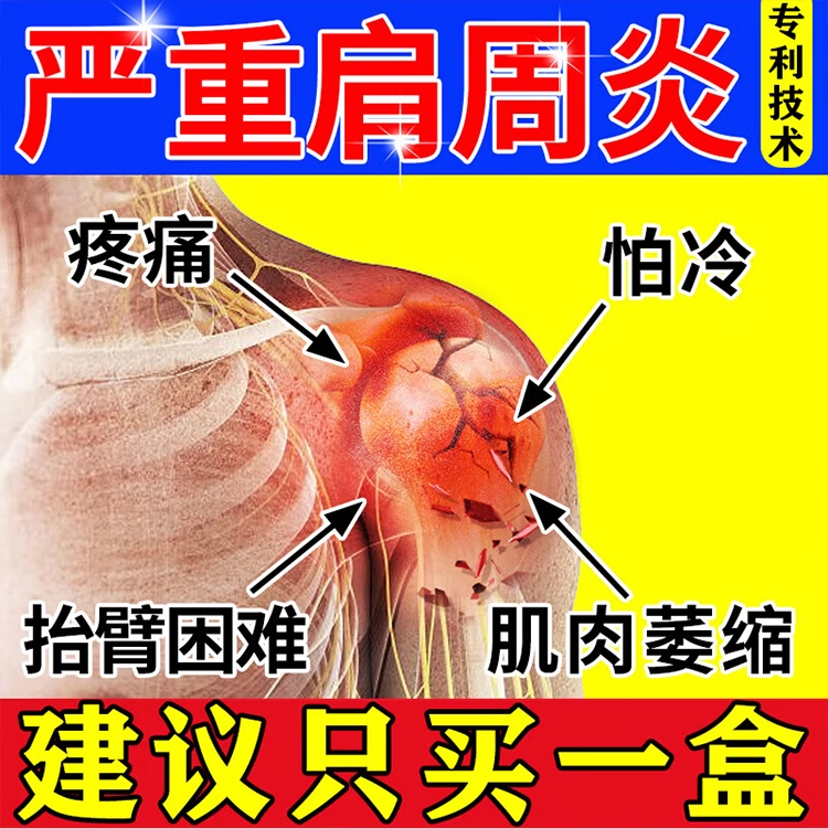 壮骨麝香止痛膏10贴舒筋活血化瘀疏通经络肩膀疼痛专用肩周炎贴膏