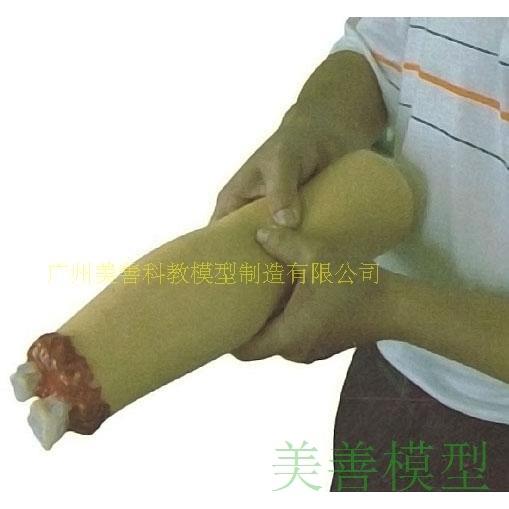 手臂断肢外伤包扎止血断肢急救训练模型上肢外伤断肢止血模型