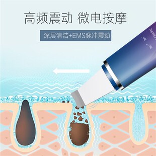 厂家定制声波铲皮机电动美容离子导入仪导出面部黑头毛孔清洁器