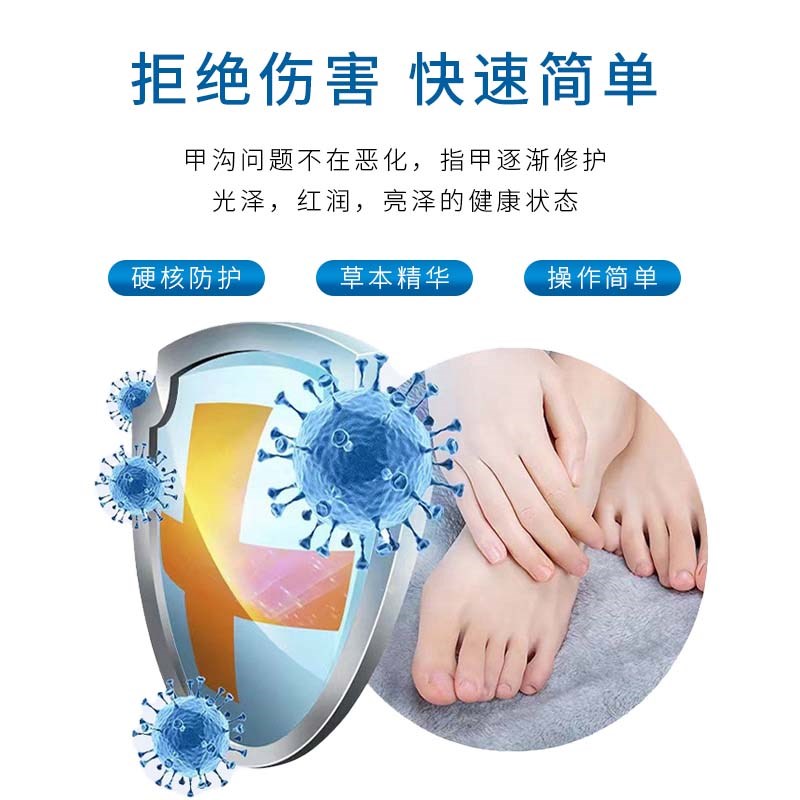 指甲沟勾炎特效去除息肉专用液脚趾甲往肉里长肉芽嵌甲软化剂药水