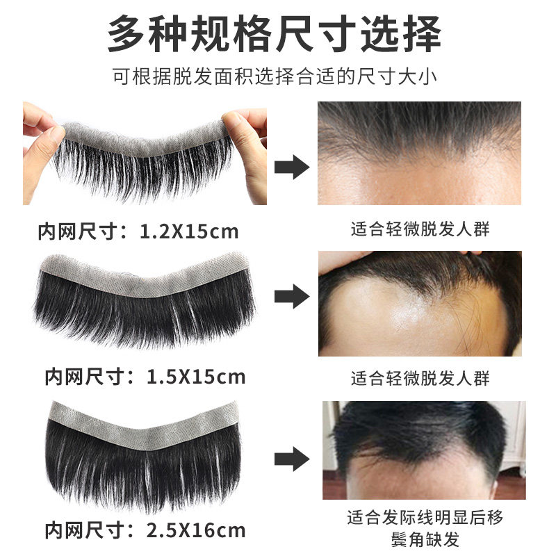 发际线假发贴男士补发片前额隐形生物头皮真发无痕M型额头假刘海