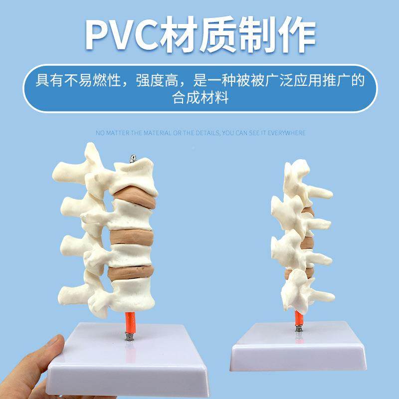 骨质蔬松模脊型人椎典型病变模型质体94脊椎模型骨疏松模具