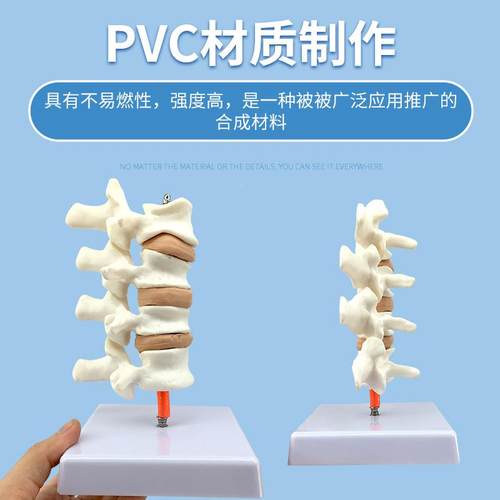 骨质蔬松模脊型人椎典型病变模型质体94脊椎模型骨疏松模具