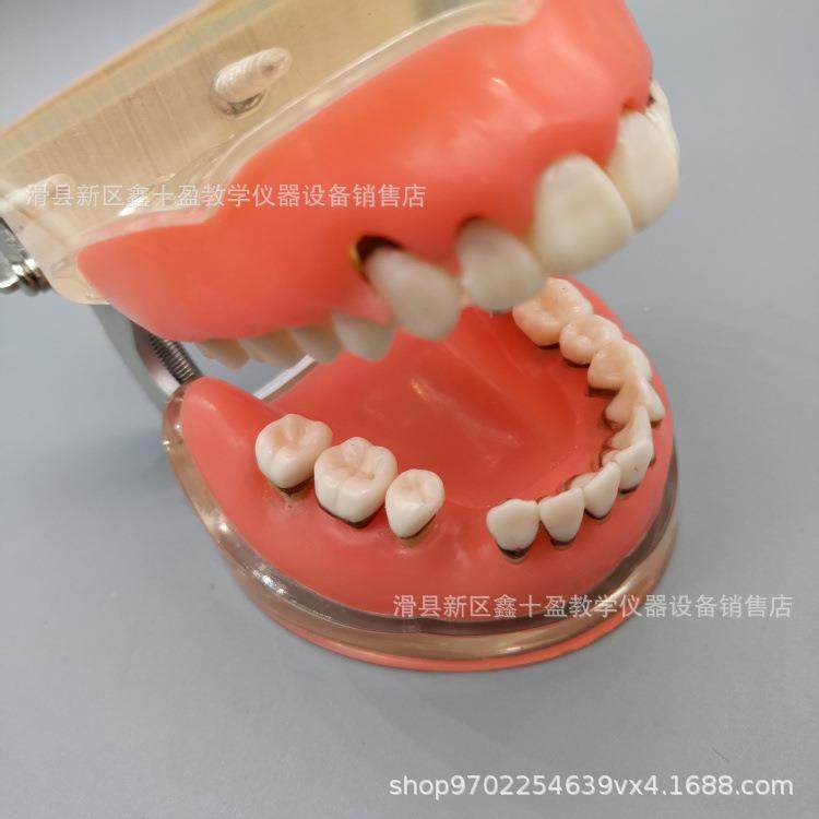 牙科病牙理模型结牙石萎缩55870牙龈缺失牙牙周洁治术练周习软牙,文具电教/文化用品/商务用品,教学标本/模型,淘宝优惠券,粉丝福利购,淘宝优惠卷
