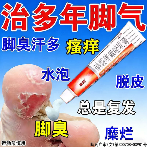 【高邦】硝酸咪康唑乳膏2%*20g*1支/盒花斑癣真菌头癣足癣酵母菌