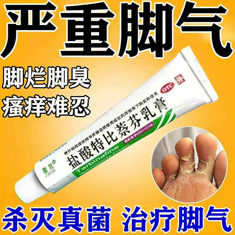 盐酸特比萘芬乳膏正品去脚气止痒脱皮杀菌脚痒臭脚烂脚丫真菌感染