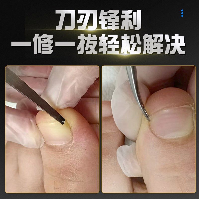 修甲沟炎专用镊子拔嵌甲钳专业修脚工具足浴修脚店家用不锈钢夹子