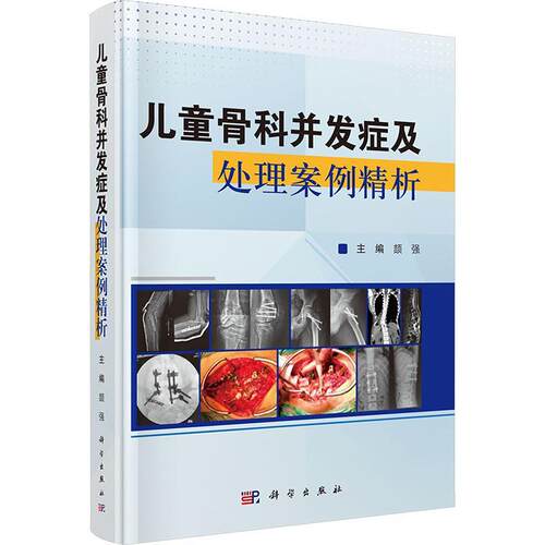 【正版新书】 儿童骨科并发症及处理案例精析 颉强 主编 科学出版社
