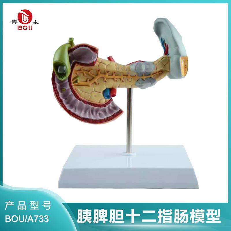 博友病变胰脾胆十二指肠模型 十二指肠病变模型 胰模型 人肝胆
