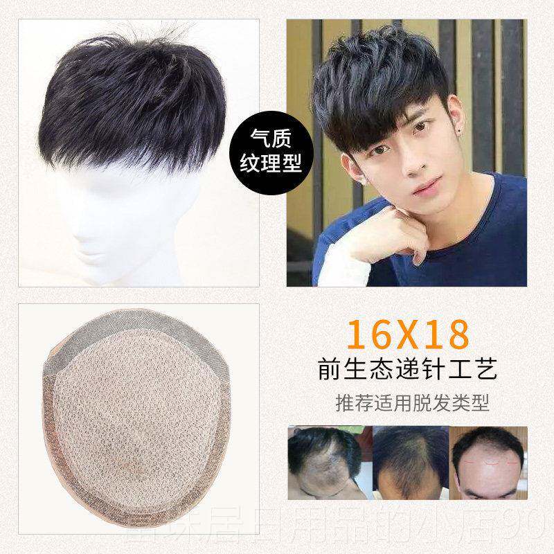 高档生男士假发头顶发男短针真发补发块前额发际线 线隐形无补痕
