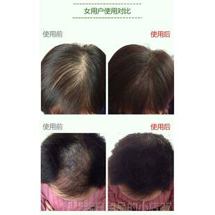 高档发纤维发维粉纤美头发假发男女增浓密发粉补发顶遮盖丰稀疏