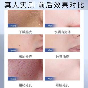 适合青少年初中生用的面霜男孩男生专用保湿青春期擦脸秋冬护肤品