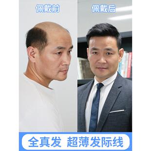 高档精递男发无痕假织发补发片男短发帅气补真士人发丝秃顶头顶发