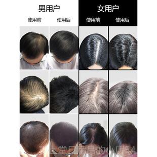 高档FUM发P增发头发纤维粉假男密女发粉P美补发浓发增发密发浓密