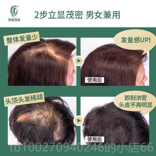 高档本利尻昆布增发纤维+发日定型喷雾发际线假发补增发密发神粉