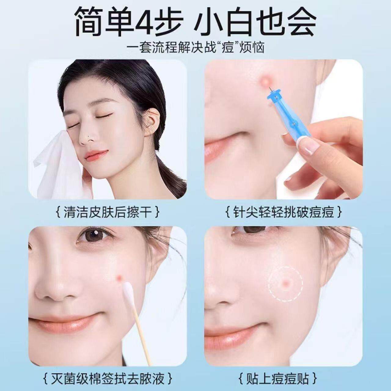 一次CAS性粉刺针脂肪针粒去除脸部油脂粒用美容专针院闭口护肤