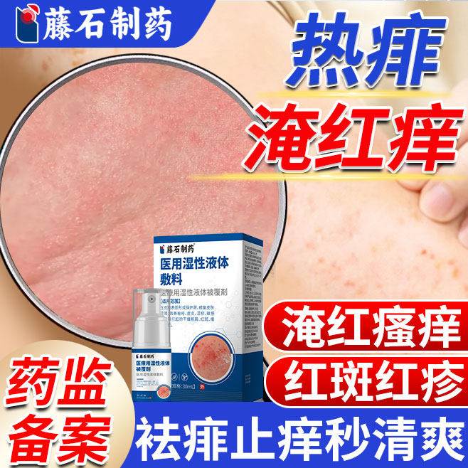 痱子去痱止痒专用成人喷雾热痱水爽身粉脖子腋下淹红房同药款膏YZ