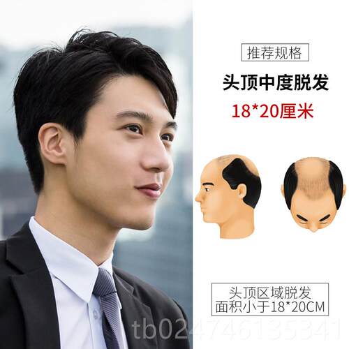 正品男士假短发帅气韩版头顶补发发片偏分额秃前中老顶年男式真发