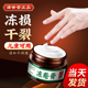 津世堂冻疮膏止痒冻伤膏正品 旗舰店消肿防冻防裂儿童专用老牌子1
