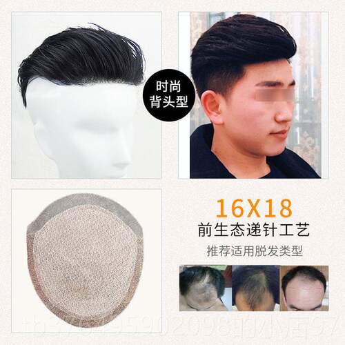 新款男发士发顶补发男短递针真补发块前额发际头线隐形无假痕生物