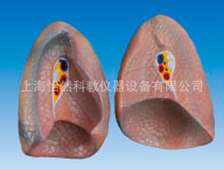 吸烟人的肺模型病理模型