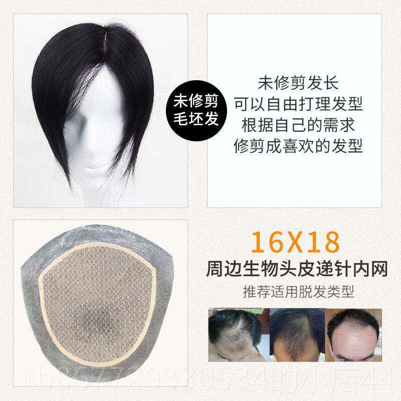 高档士假发男顶补发男短递针真发补发块前际额发线头隐形无痕生物
