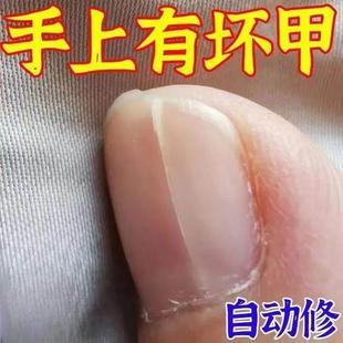 指甲营养液油增长液修护甲床增厚竖纹防断空甲 养出自然真指甲
