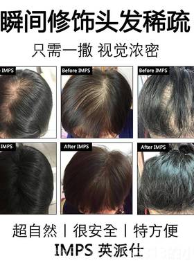 高档IMPS发际线 线填充浓密增头美神发补发器密发增发多假发粉发
