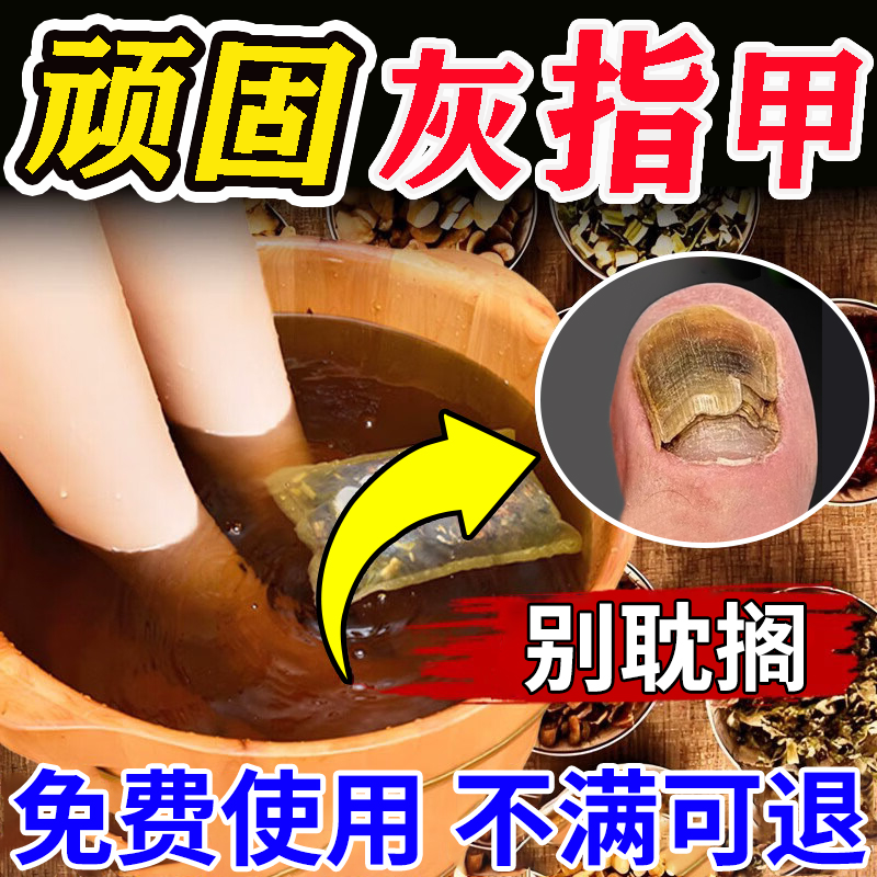 治灰指甲用专抑真菌感染液日本根疗效第一名滴净亮旗舰店正品药水