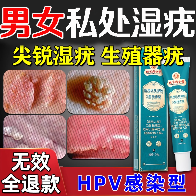 尖锐湿疣男女性私处除干扰素菜花病毒生殖器下面长疙瘩hpv去凝胶