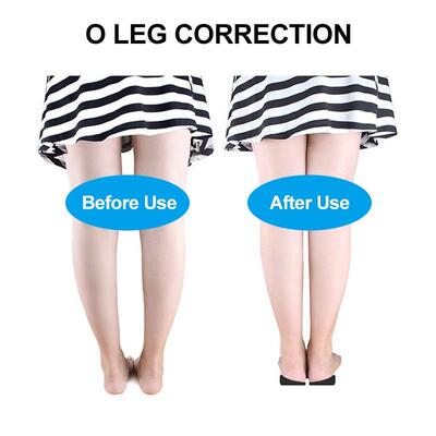 2Pcs Orthopedic Insoles For X/O-type Legs Foot Corrector Gel